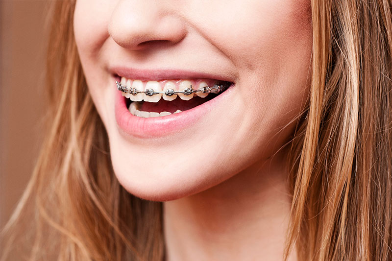 Orthodontics in Visalia