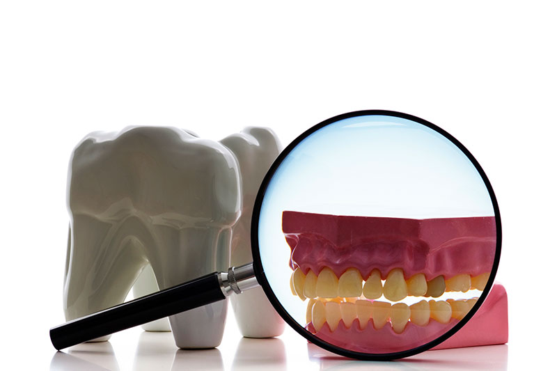 Root Canal in Visalia