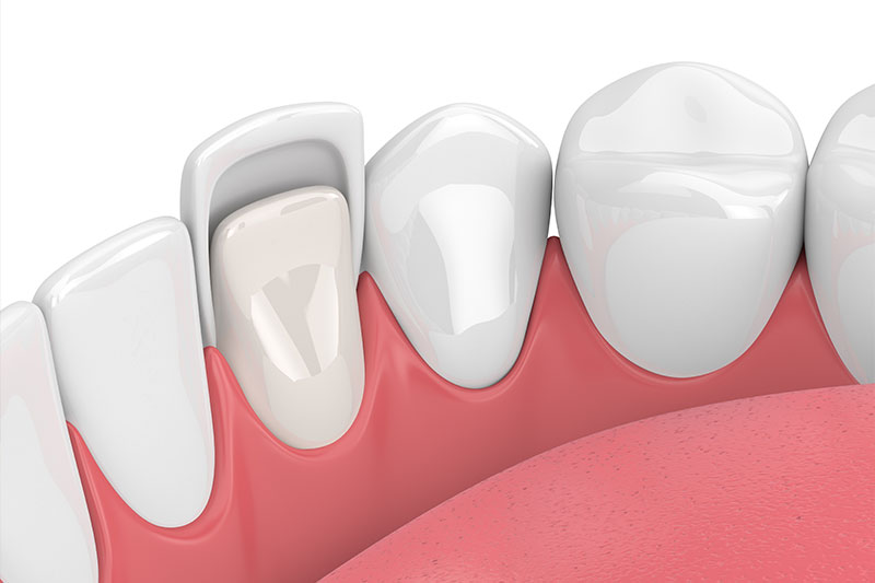 Cosmetic Dentistry in Visalia
