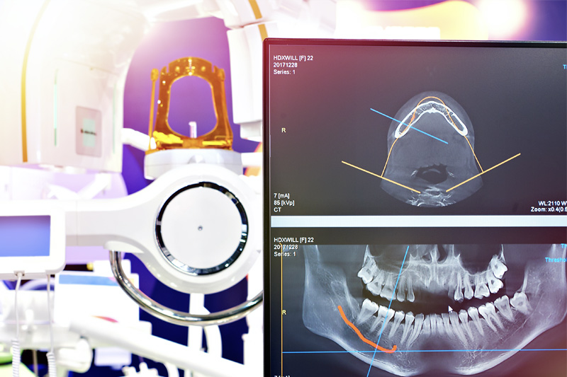 Digital X-Rays in Visalia