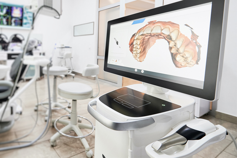Intra-Oral Scanner in Visalia